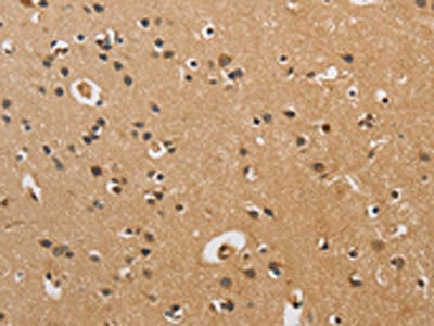 CST6 Antibody