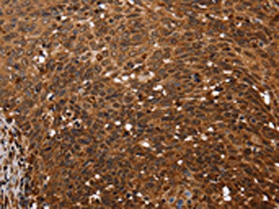 FANCF Antibody