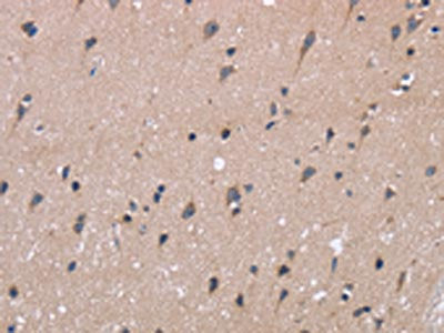 KIAA1324 Antibody