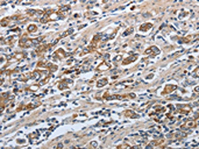 SLC34A2 Antibody