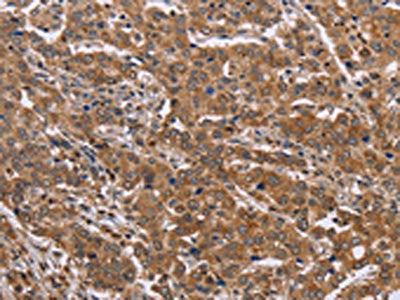 FAAH2 Antibody