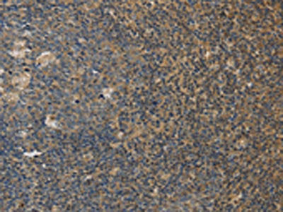 DDX19B Antibody