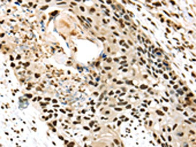 TALDO1 Antibody