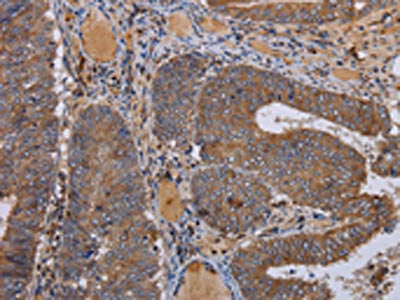 FADS1 Antibody