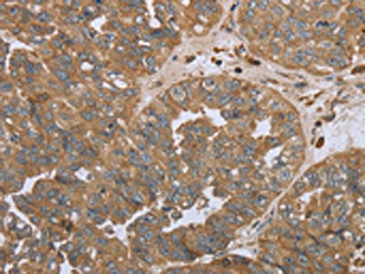 NPR2 Antibody