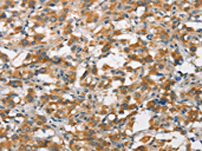 FZD1 Antibody
