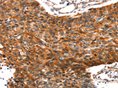 TRIM69 Antibody