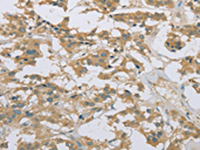 EEF2 Antibody