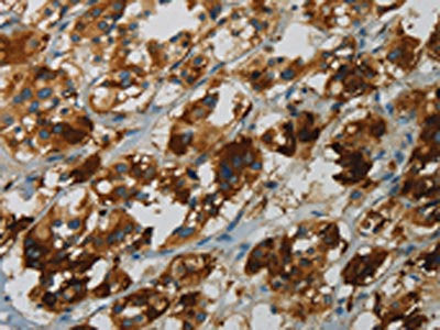 FBXO32 Antibody