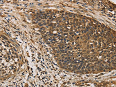 DACH1 Antibody