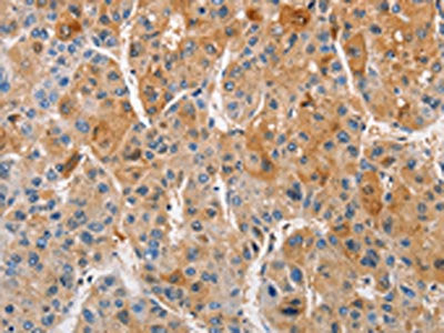 PRKCE Antibody