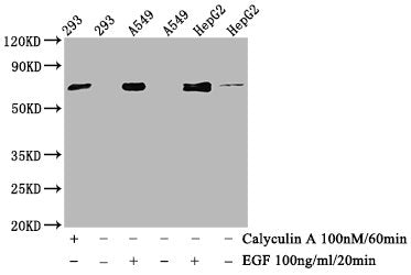 Phospho-ATF2 (T71) Antibody