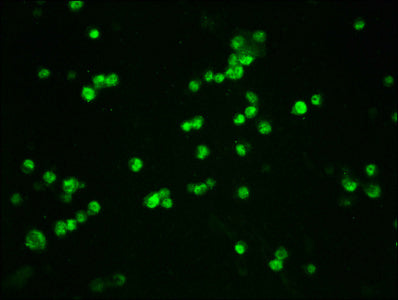 Phospho-CTNNB1 (S33/S37) Antibody