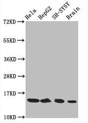 Acetyl-Histone H3.1(K14)Antibody