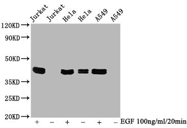 Phospho-MAPK3 (T202/Y204) + MAPK1 (T185/Y187) Antibody
