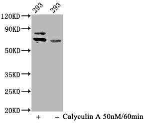 Phospho-RPS6KB1 (T421+S424) Antibody