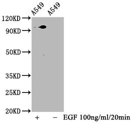 Phospho-STAT3 (S727) Antibody