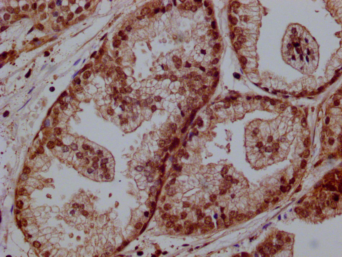PRKAG1 Antibody