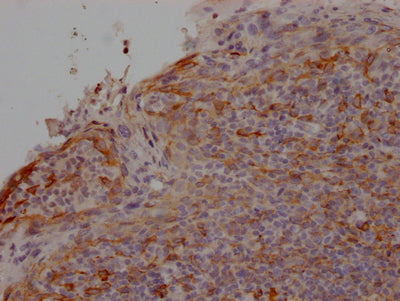 CCR2 Antibody