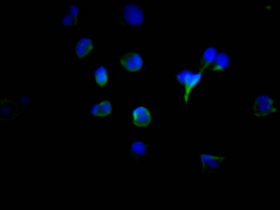 TYR Antibody