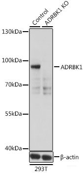 (KO Validated) ADRBK1 Polyclonal Antibody