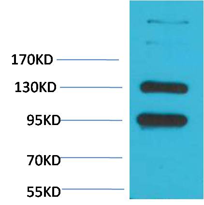 CaVα2δ1 Rabbit pAb