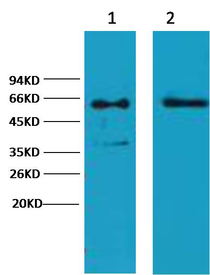 Cytokeratin 6 Mouse mAb
