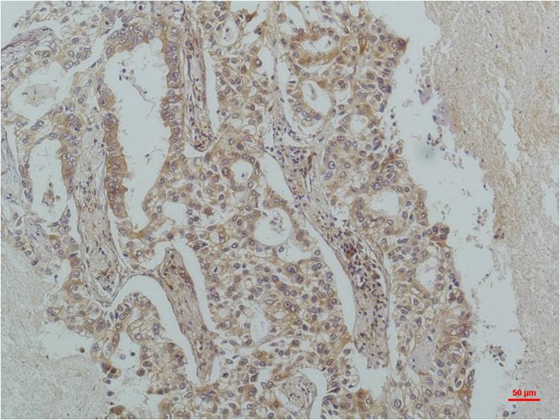 IκB β Mouse mAb