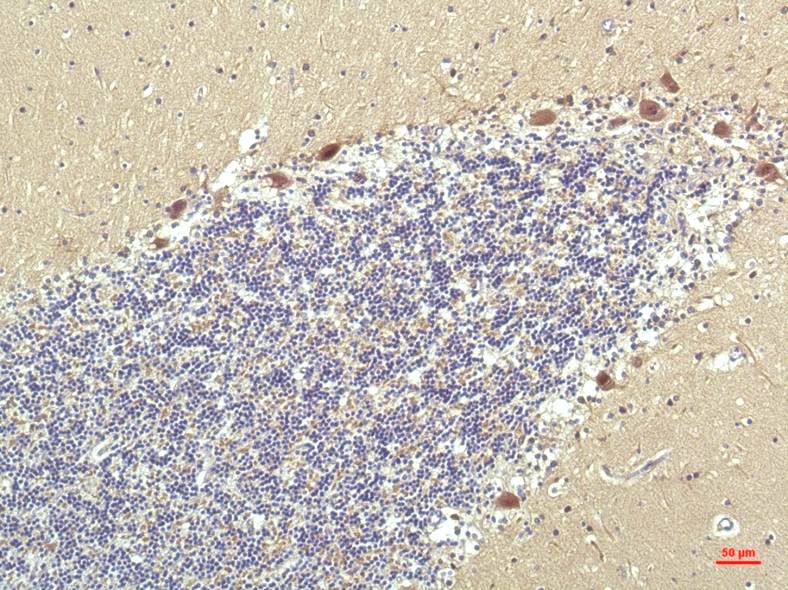 PPAR Delta (2F9) Mouse mAb