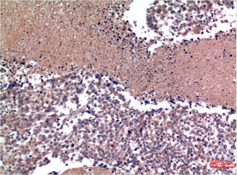 Cyclin B1 (1A5) Mouse mAb