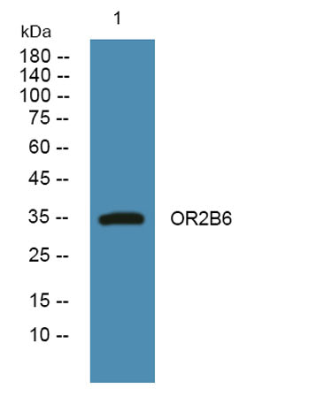 OR2B6 rabbit pAb