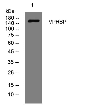VPRBP rabbit pAb