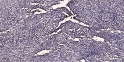 SQSTM1/p62 (phospho-Ser403) rabbit pAb