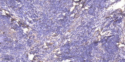 SGK3 (phospho-Thr320) rabbit pAb