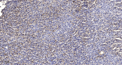 SF3B1 (phospho-Thr313) rabbit pAb