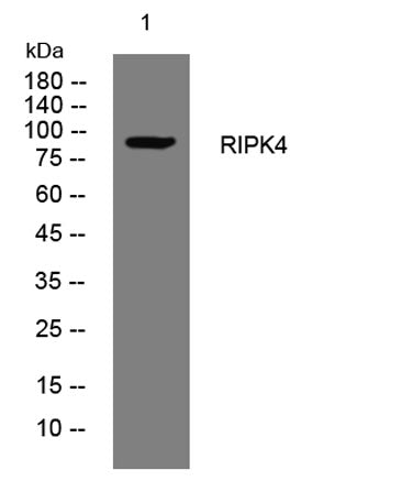 RIPK4 rabbit pAb