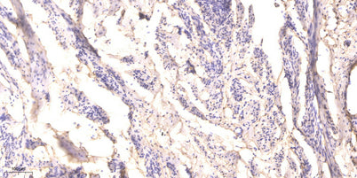 RIP (phospho-Ser166) rabbit pAb