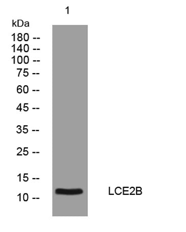 LCE2B rabbit pAb