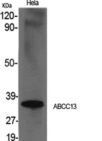 ABCC13 rabbit pAb