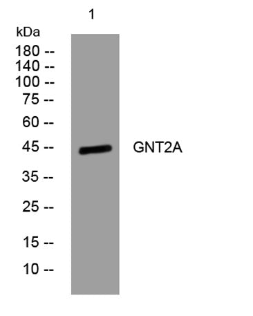 GNT2A rabbit pAb