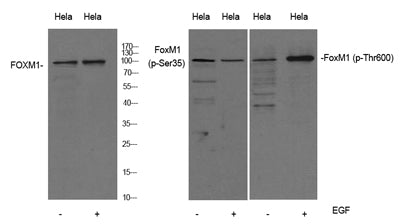 FoxM1 (phospho-Ser35) rabbit pAb