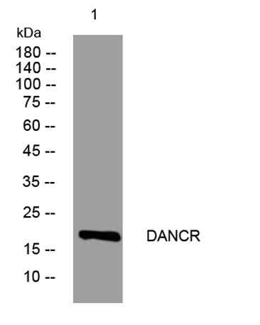 DANCR rabbit pAb