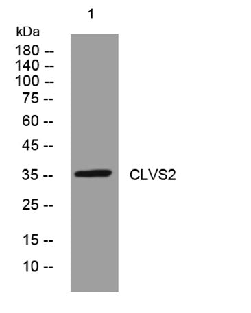 CLVS2 rabbit pAb