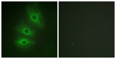 A Cyclase V/VI rabbit pAb