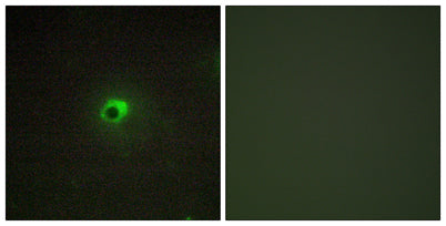 ACTR-IC rabbit pAb