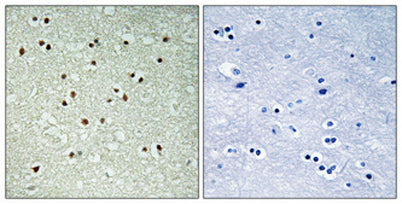 NCoA-7 rabbit pAb