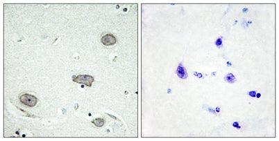 c-Fms (phospho Tyr809) rabbit pAb