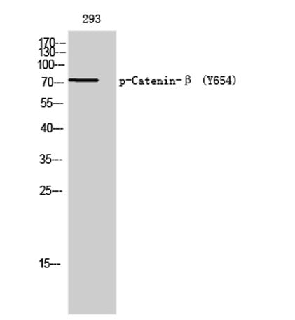 Catenin-β (phospho Tyr654) rabbit pAb