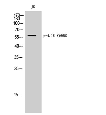 4.1R (phospho Tyr660) rabbit pAb