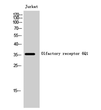 Olfactory receptor 6Q1 rabbit pAb
